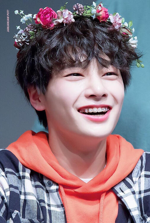 his braces TT